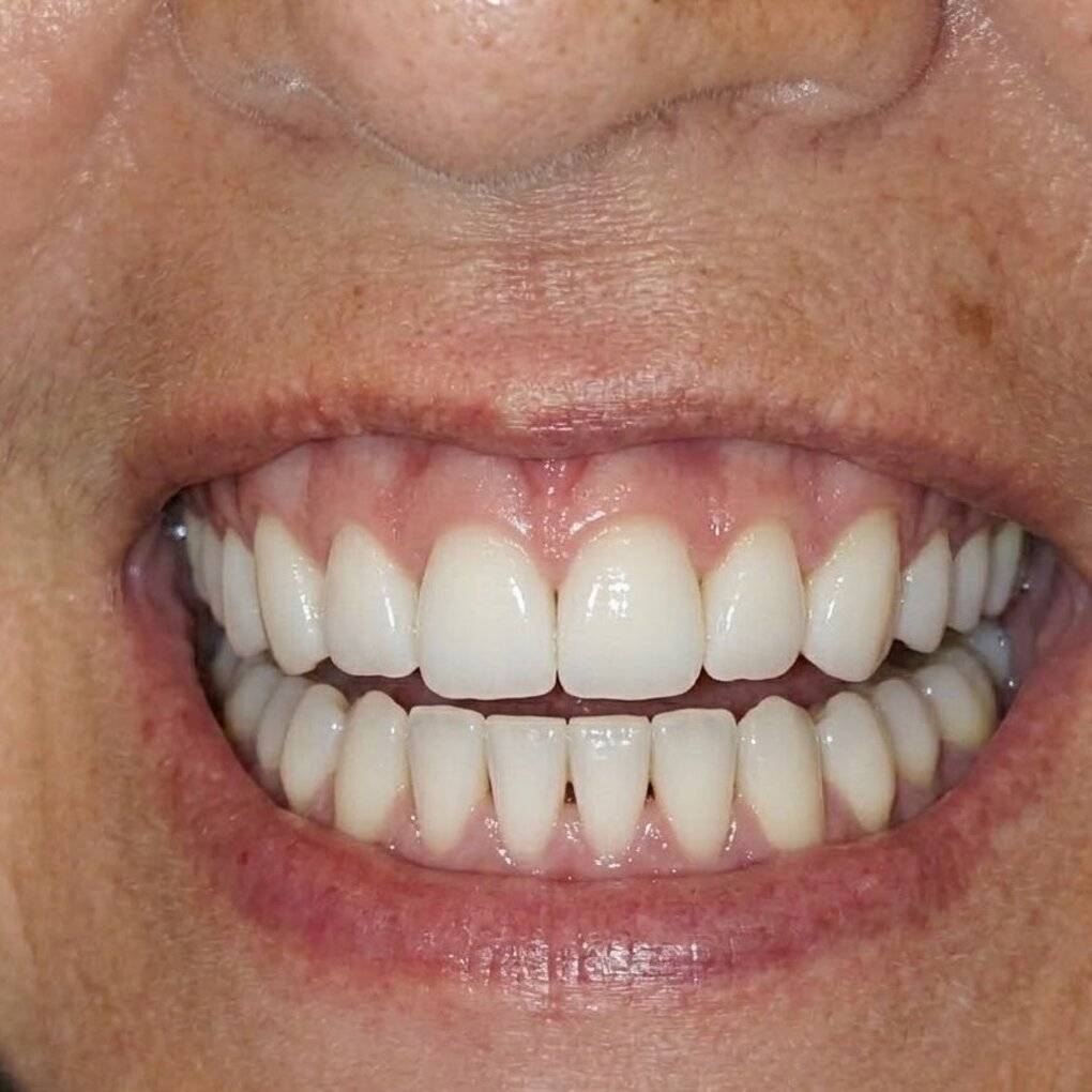 estetica dentista roma prati dott. antonio romano mei ccaldora